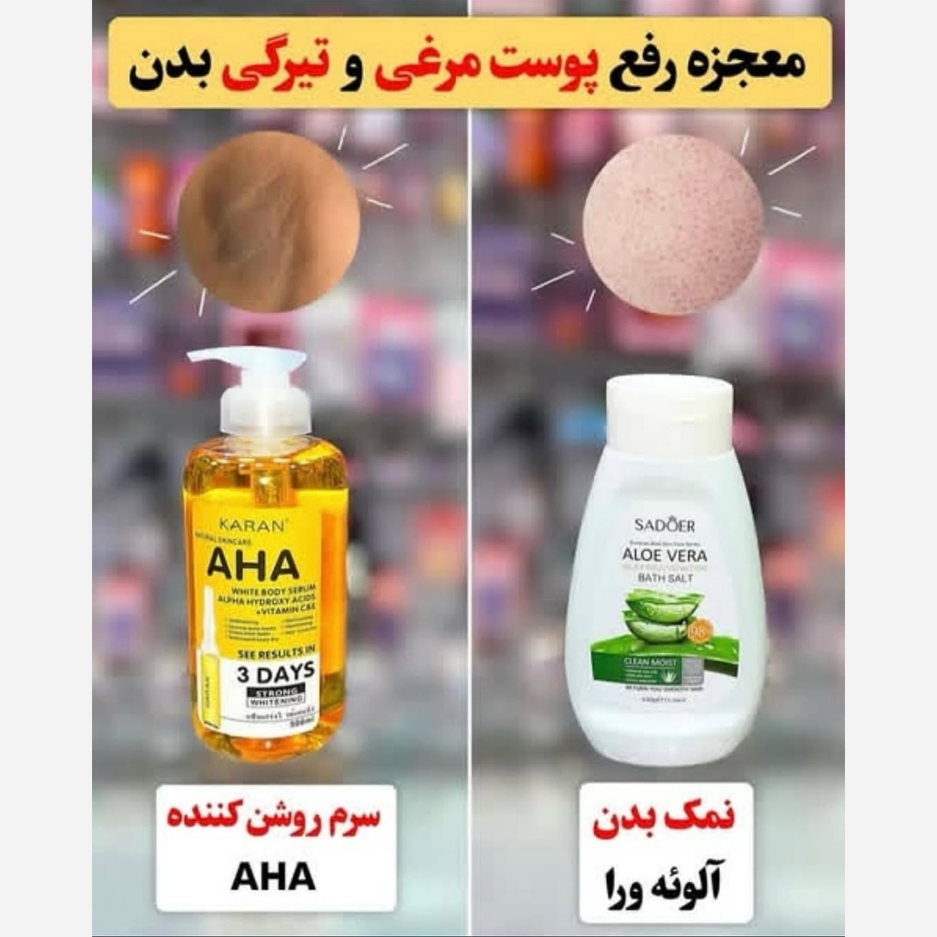 پک رفع پوست مرغی بدن و روشن کننده بدن ( نمک بدن آلوئه ورا و سرم AHA )